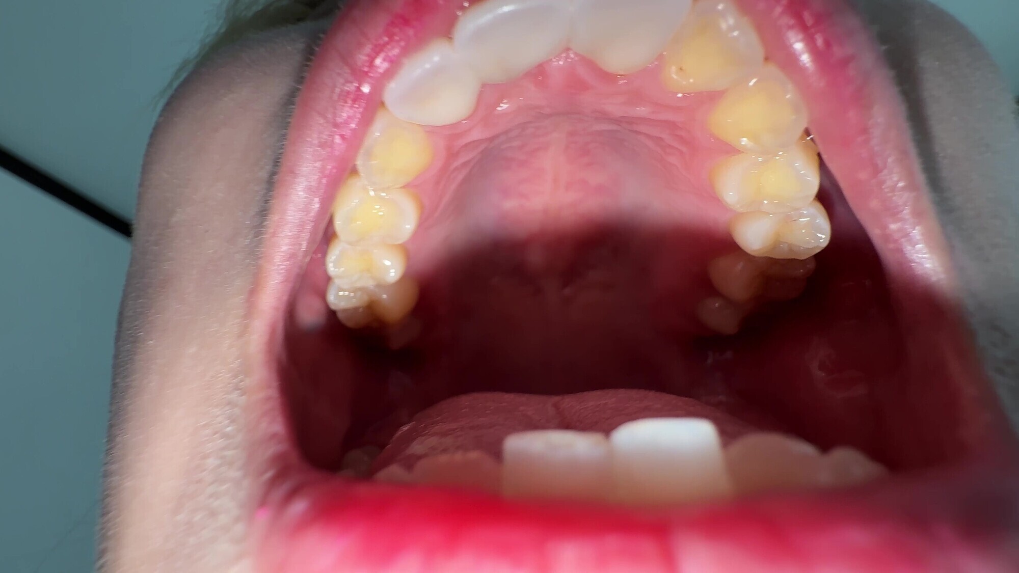 【個人撮影】安堂はるの 歯並び綺麗な強め噛みつき