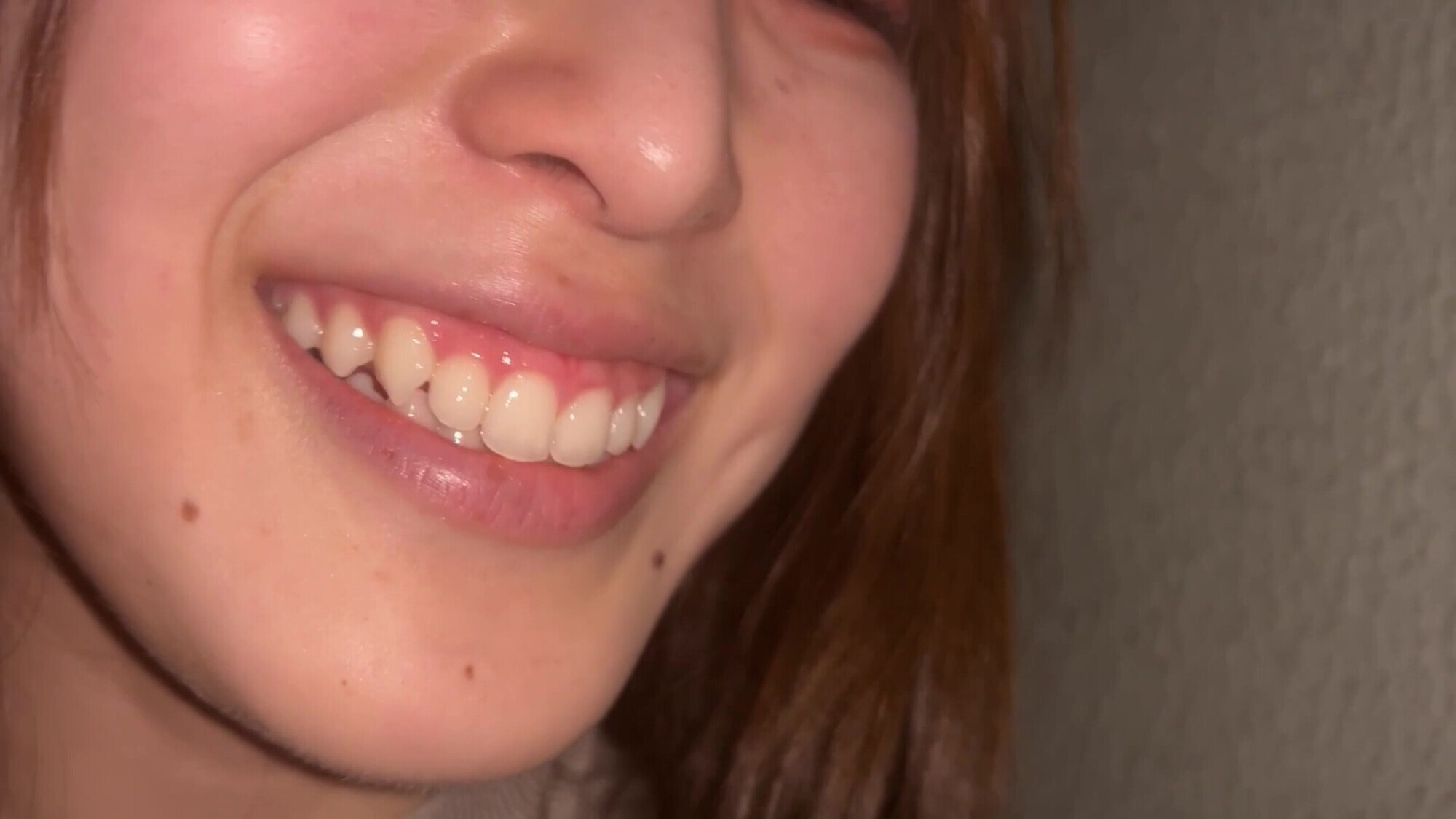 【特価】口腔観察 VOL.1 8名150分お買い得セット