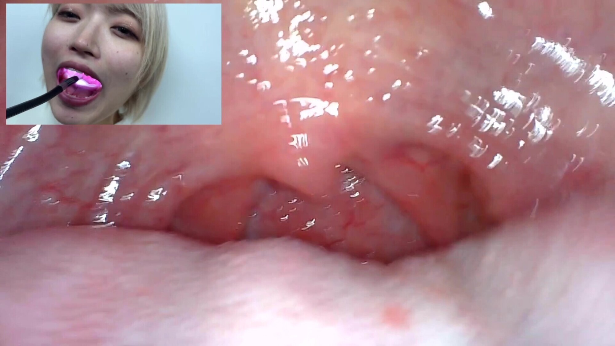 【特価】口腔観察 VOL.2 4名55分お買い得セット