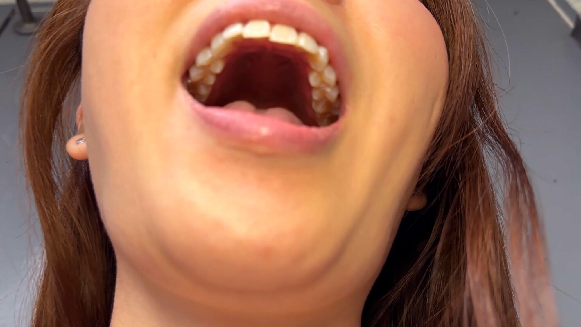 街角で声をかけて口内観察させてもらう 商社営業 れなちゃん